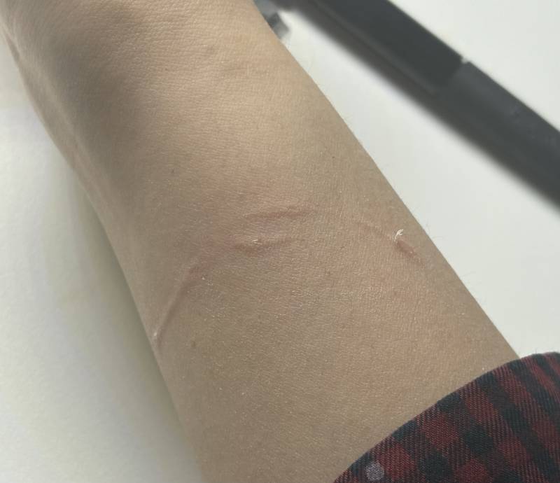 [잡담] 하 진짜 자는데 이불덮어주는데 보더니 갑자기 콱 깨물음 | 인스티즈
