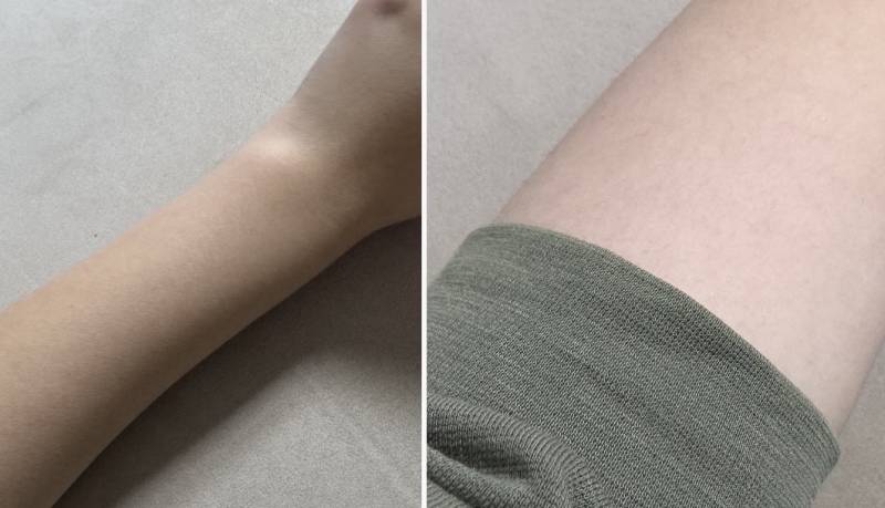 [잡담] 화이트태닝하면 탄 피부 돌아와? | 인스티즈