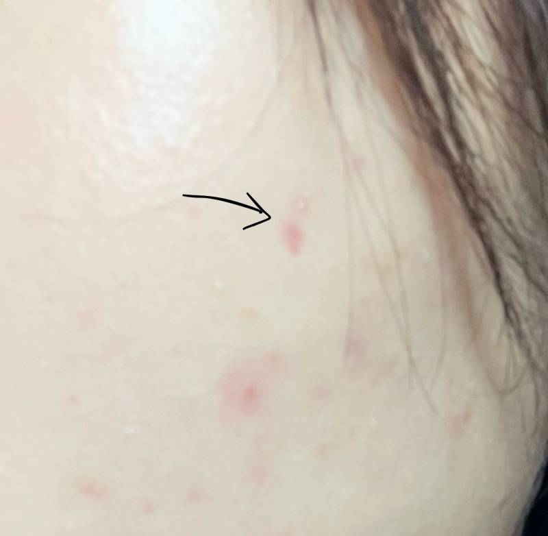 [잡담] 설마 이게 패인흉터인가 ? | 인스티즈