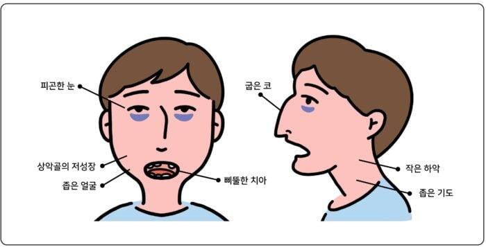 [잡담] 익들아 지금 빨리 혀 위치 확인해 | 인스티즈