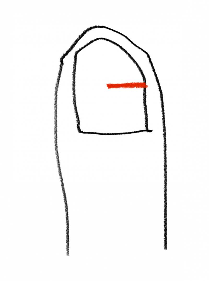 [잡담] 손톱이 그림처럼 찢겼?? 부러졌??는데 | 인스티즈