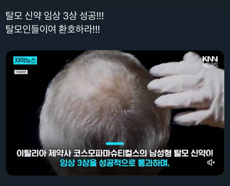 [잡담] 이열 탈모인들 드디어 탈출하는거임? | 인스티즈