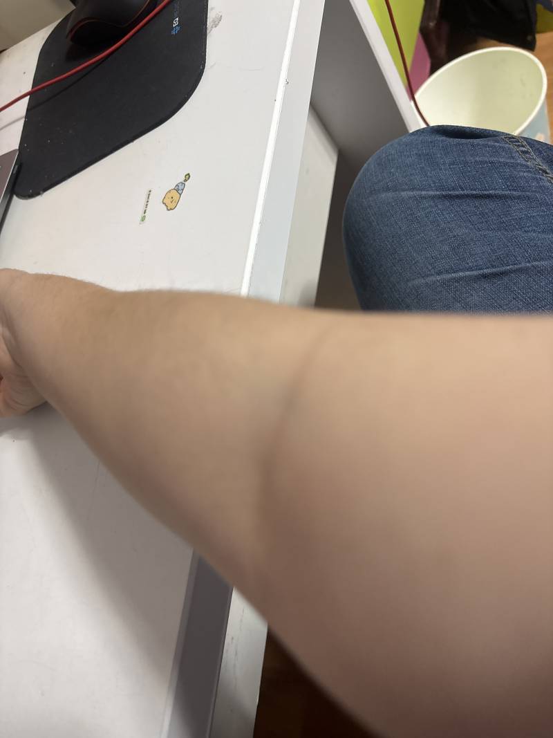 [잡담] 팔 꺾은거 고소가능? | 인스티즈