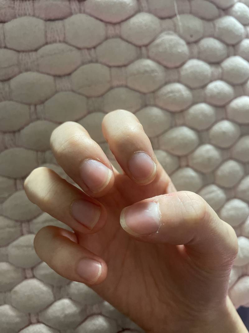 [잡담] 손톱 못 생겼지..? | 인스티즈