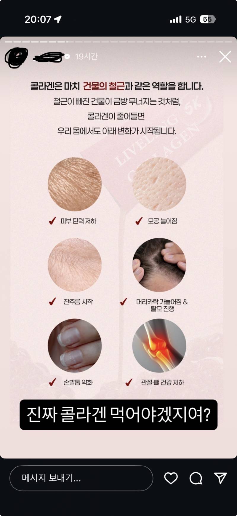 [잡담] 인스타 공구중에 콜라겐 혹하긴한다 | 인스티즈