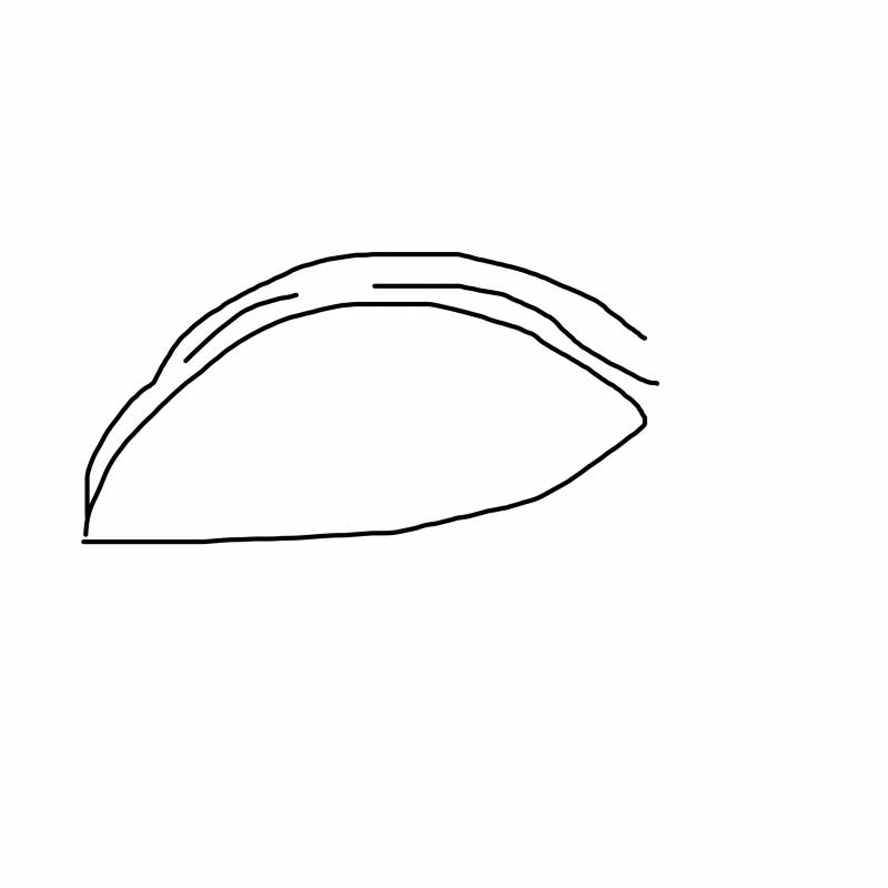 [잡담] 자연쌍커풀 계속 풀려서 수술 고민 중인데 | 인스티즈