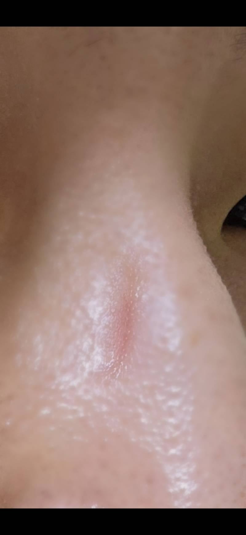 [잡담] 이거 안경 코받침 각도가 잘못된건가 (놀람주의) | 인스티즈