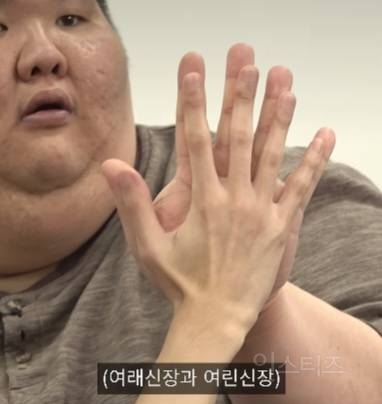 충격적인 46kg 남자와 240kg 남자의 팔 비교.jpg | 인스티즈