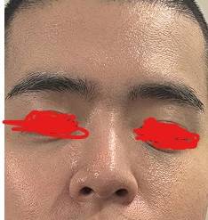 [잡담] 남잔데 피부 어떤 편인가? | 인스티즈