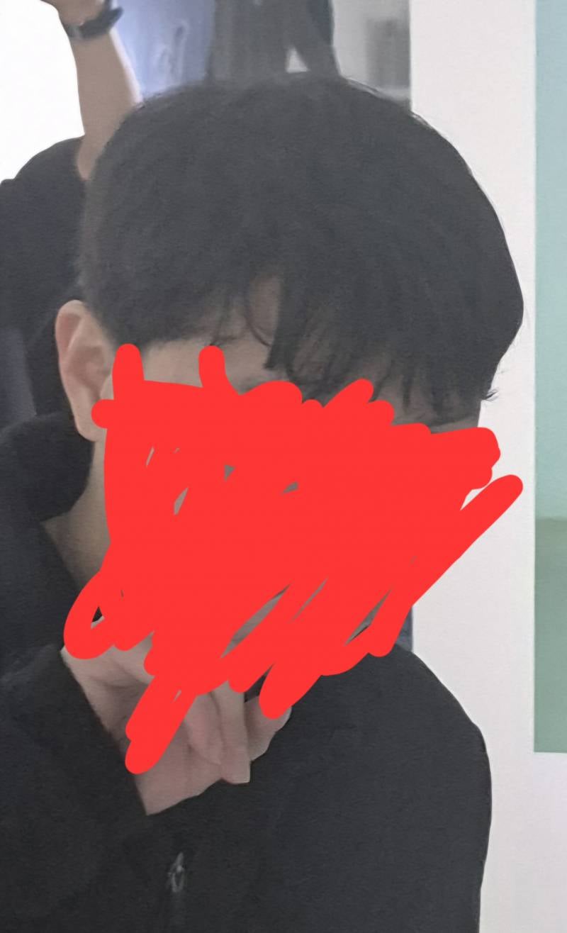 [잡담] 저 이거 앞머리 갈라진거 탈모인가요? | 인스티즈