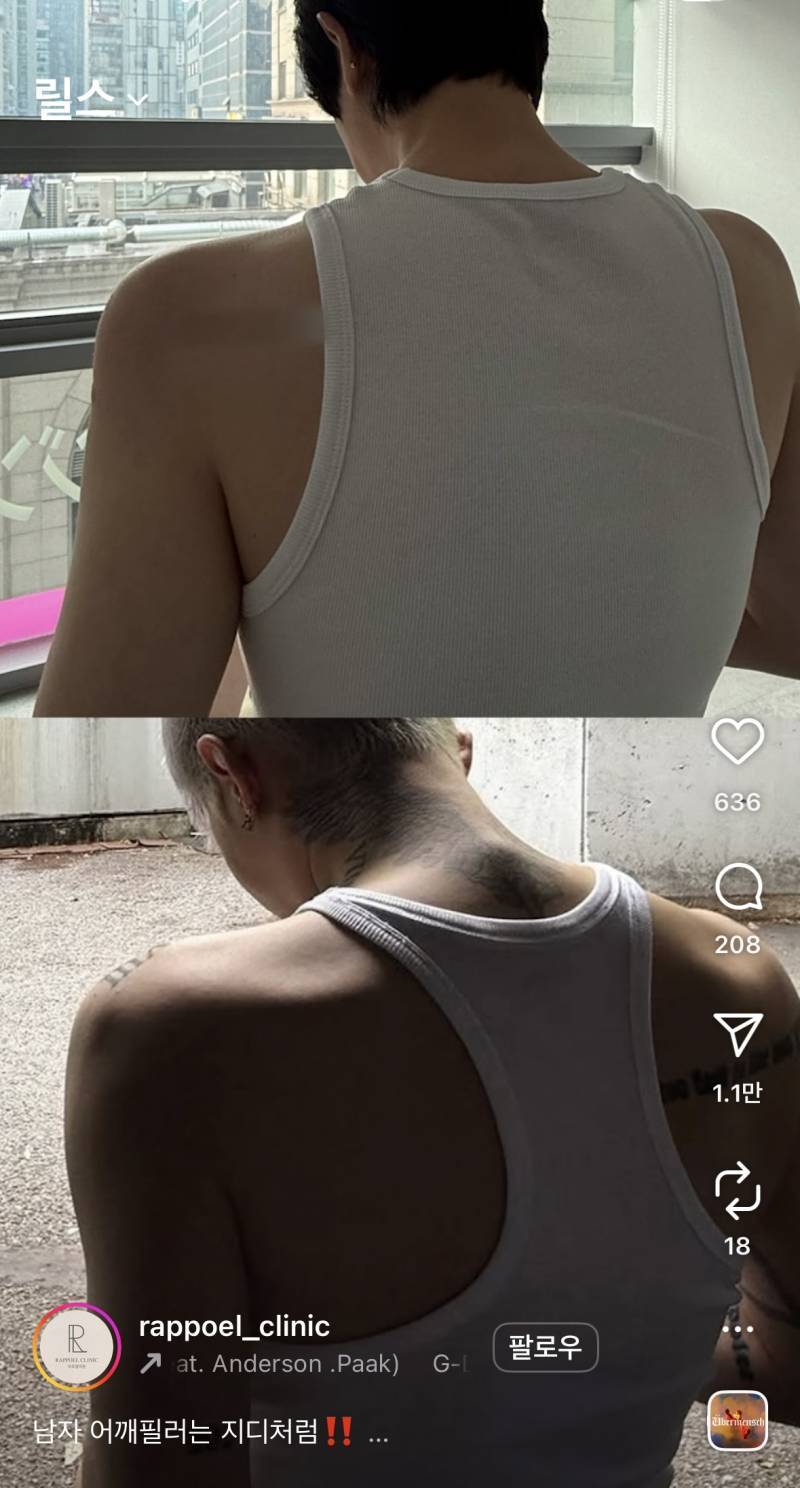 현재 어깨 필러 맞았다는 조두팔..JPG | 인스티즈