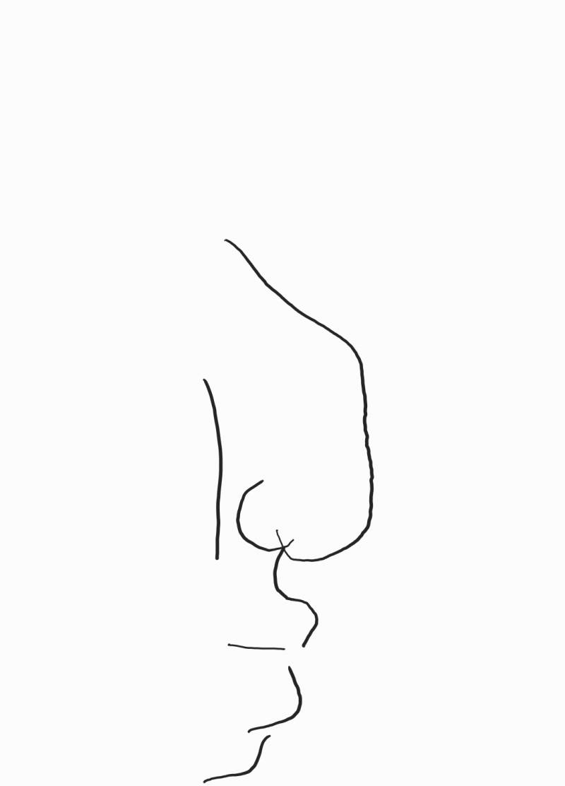 [잡담] 코성형vs지방흡입 | 인스티즈
