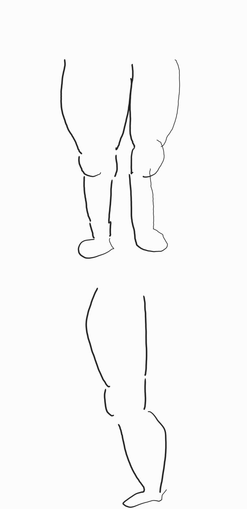 [잡담] 코성형vs지방흡입 | 인스티즈