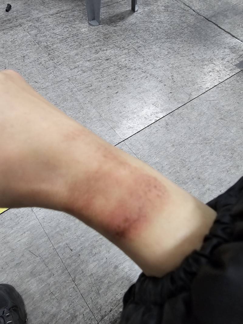[잡담] 이거 뭐라고그래? 이름을 몰라서 검색도 어렵네 ㅠ | 인스티즈