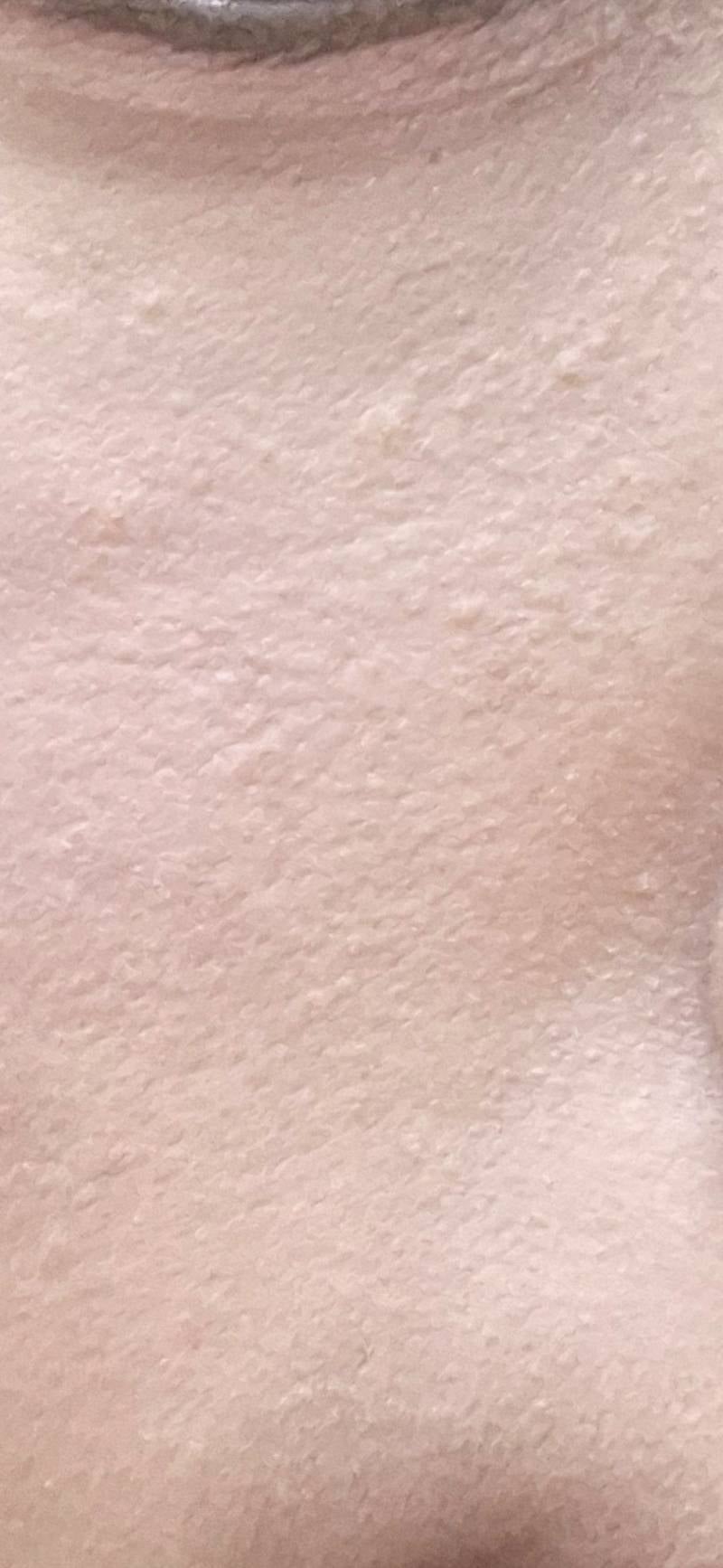[잡담] 베이스 했는데 이렇개 오돌토돌한건ㅠㅠ | 인스티즈