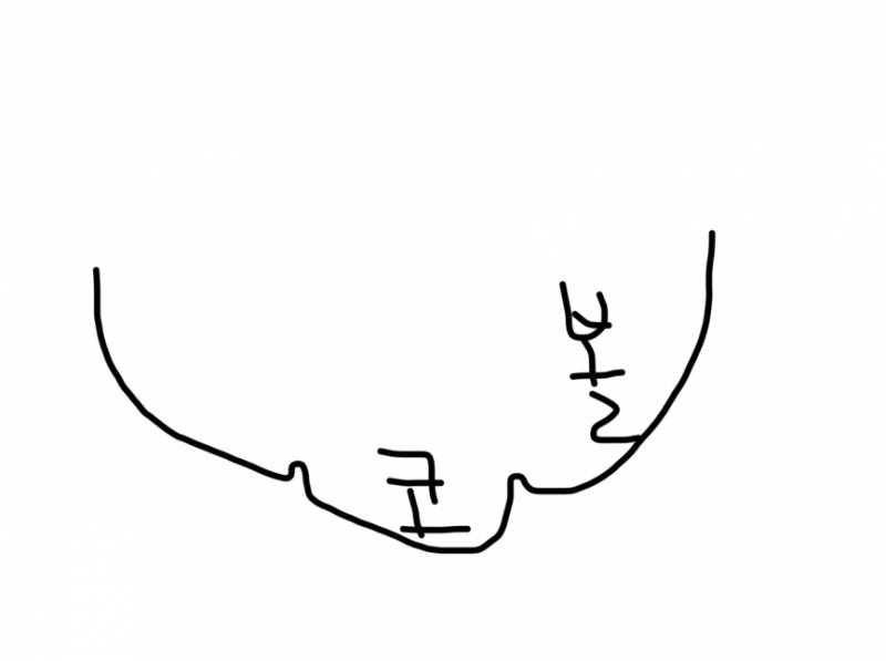 [잡담] 쿠션 코 끼임은 어쩔 수 없지? | 인스티즈