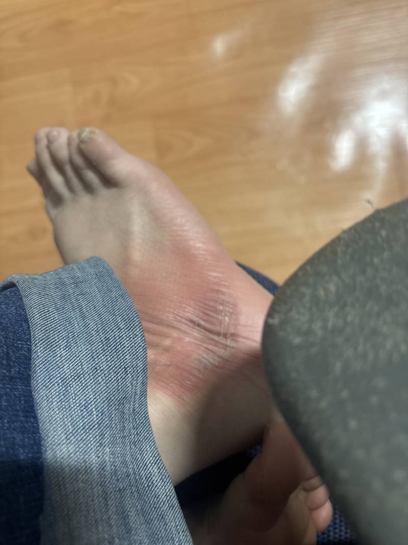 [잡담] 증상더심해짐 | 인스티즈
