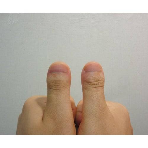 [잡담] 너네는 지인이 얼굴은 진짜 예쁜데 손톱이 이러면 좀 깰 거 같아? | 인스티즈