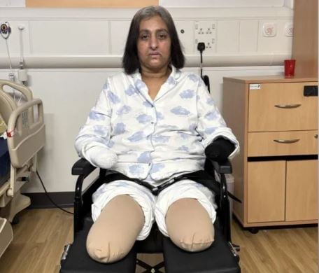 "사지 절단하고 심정지 6번” 50대 女… 반려견의 뽀뽀가 문제였다 | 인스티즈