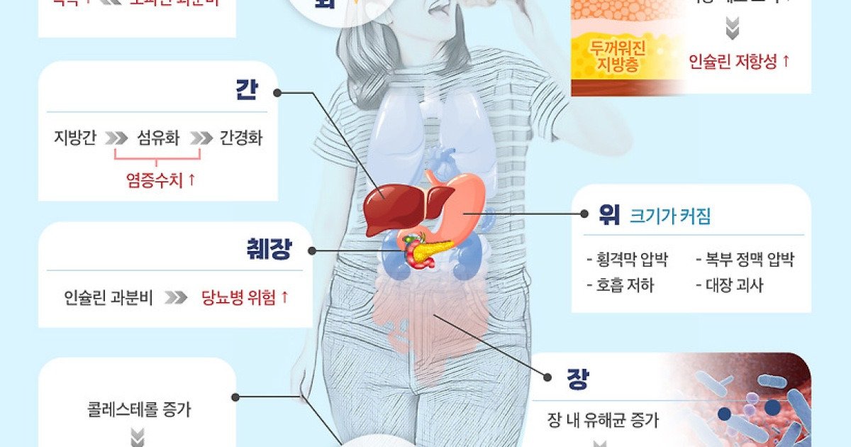 먹방 유튜버 줄줄이 사망… 몸 '이렇게' 병들어 갔을 것 | 인스티즈