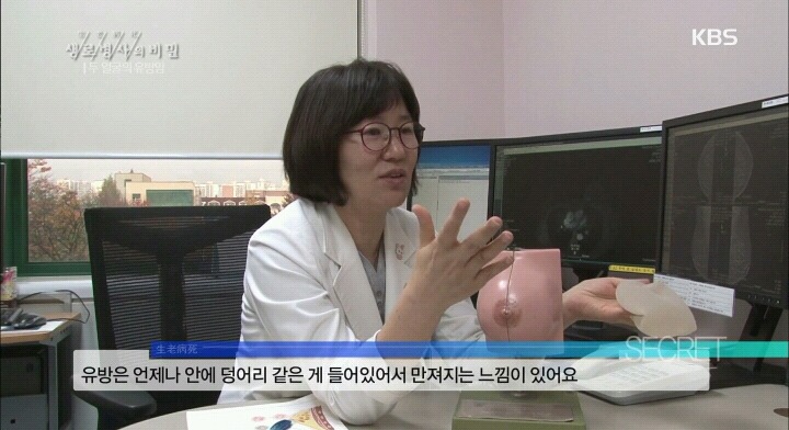 가슴에 멍울은 다 있는거 아님? 유방암이랑 뭐가 달라? | 인스티즈