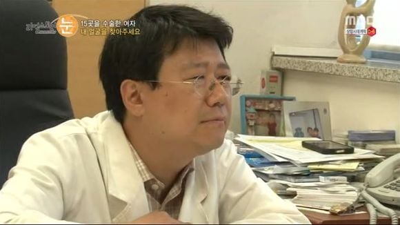 [리얼스토리눈] 15곳을 수술한 여자 내 얼굴을 찾아주세요 (성형수술 부작용) | 인스티즈