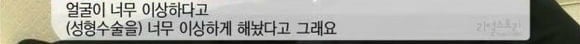 [리얼스토리눈] 15곳을 수술한 여자 내 얼굴을 찾아주세요 (성형수술 부작용) | 인스티즈