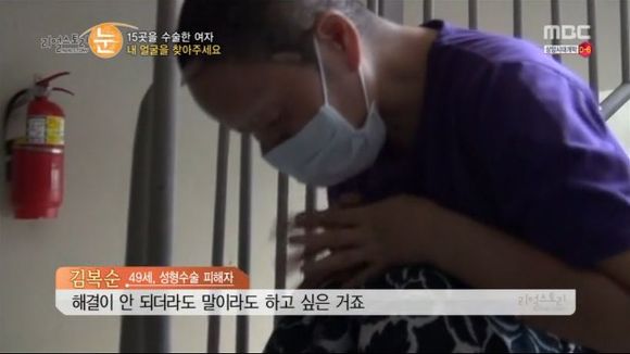 [리얼스토리눈] 15곳을 수술한 여자 내 얼굴을 찾아주세요 (성형수술 부작용) | 인스티즈