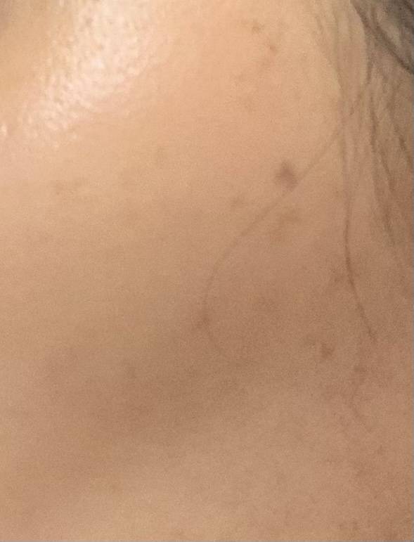 [잡담] 피부과에 일하는 익인 있어? 궁금한거 있는데 ㅠㅠ | 인스티즈