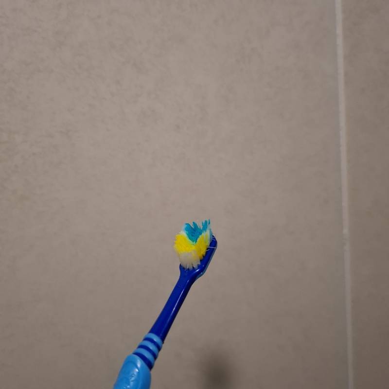 [잡담] 칫솔 이 정도면 바꿀거야? | 인스티즈