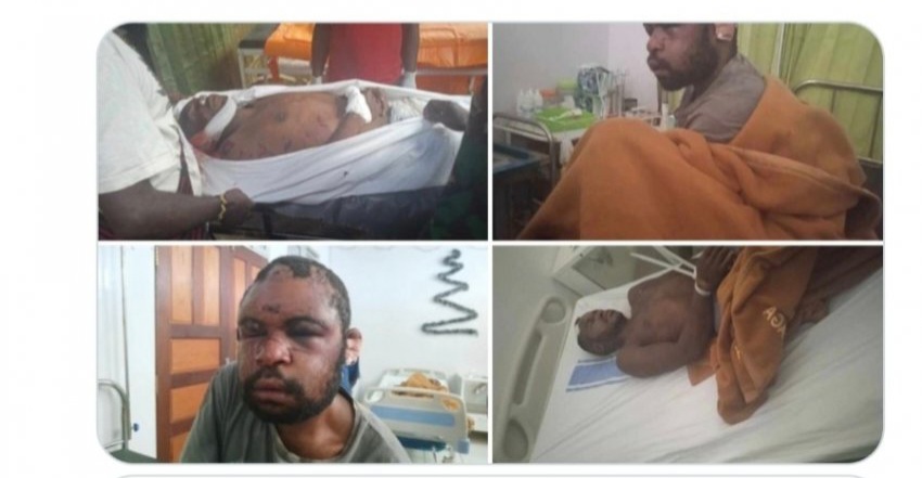 [잡담] 인도네시아 파푸아는 지금도 시위하고 그러던데 | 인스티즈