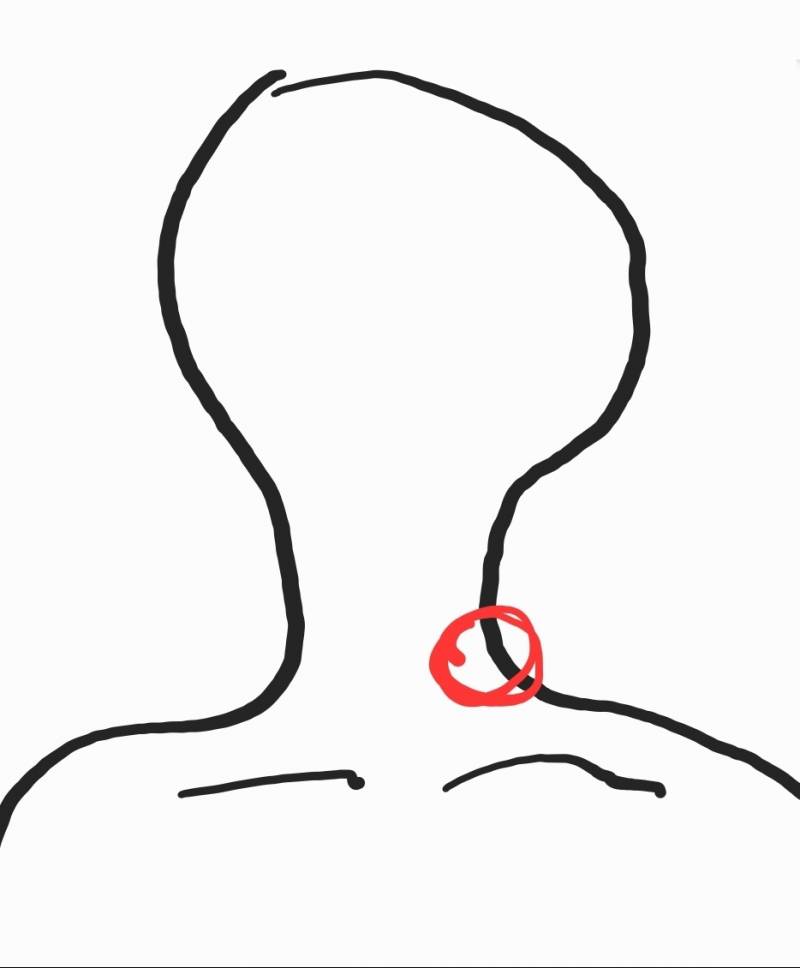 [잡담] 목에 가시 박혀본 익 있니.. | 인스티즈