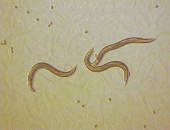 [잡담] 예쁜꼬마선충이라는데 | 인스티즈