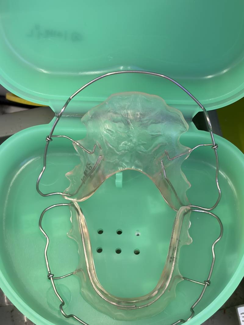 [잡담] 유지장치 왜케 웃기게 생겼냐 | 인스티즈