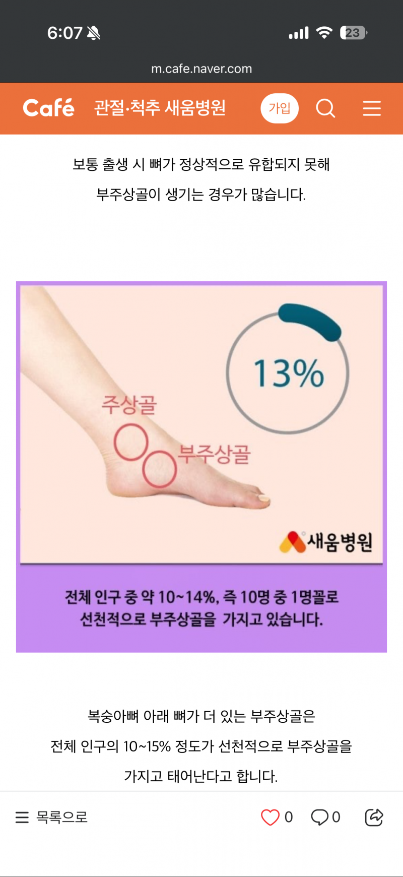 [잡담] 아니 여기 뼈 없는 사람도 있어?? | 인스티즈