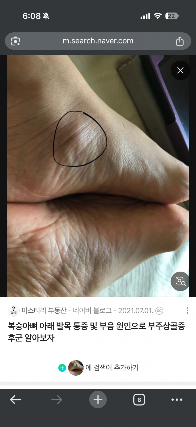 [잡담] 아니 여기 뼈 없는 사람도 있어?? | 인스티즈