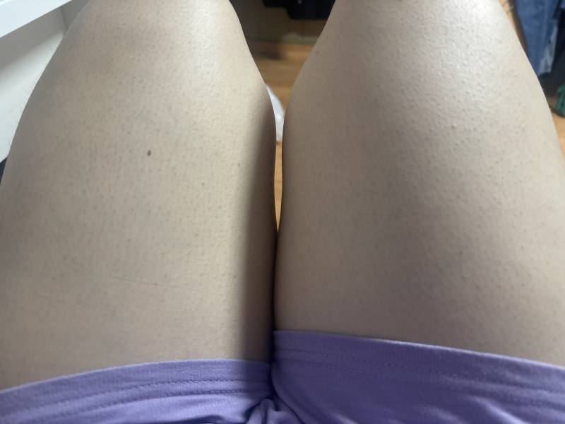 [잡담] 다리 ㄹㅇ굵다 원래 상비엿는데 상하둘다비만댐 | 인스티즈