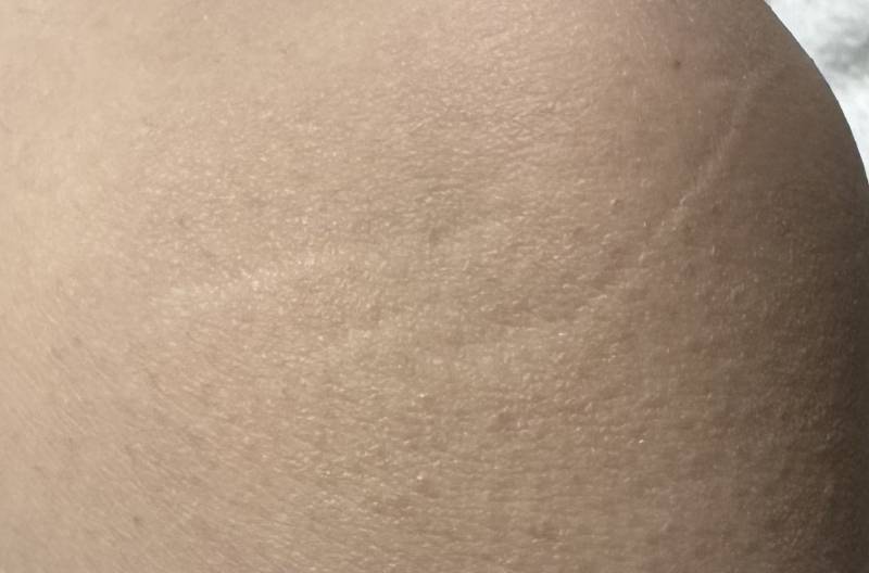 [잡담] 무릎에 이거 뭘까 | 인스티즈