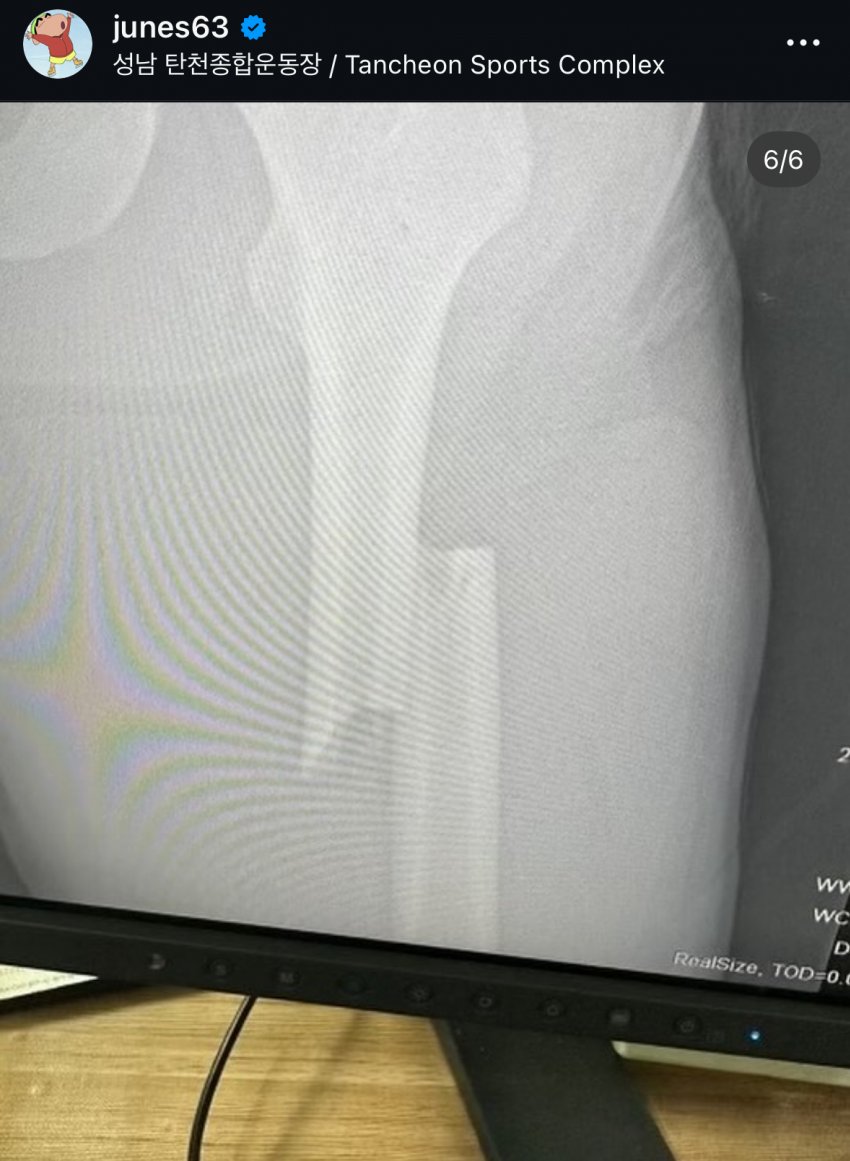 [잡담] 와 쇼트 계주 이준서 상태가 이랬었대... | 인스티즈