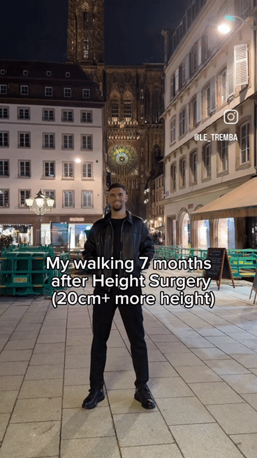 172cm -> 194cm 키높이 수술 7개월 후.gif | 인스티즈