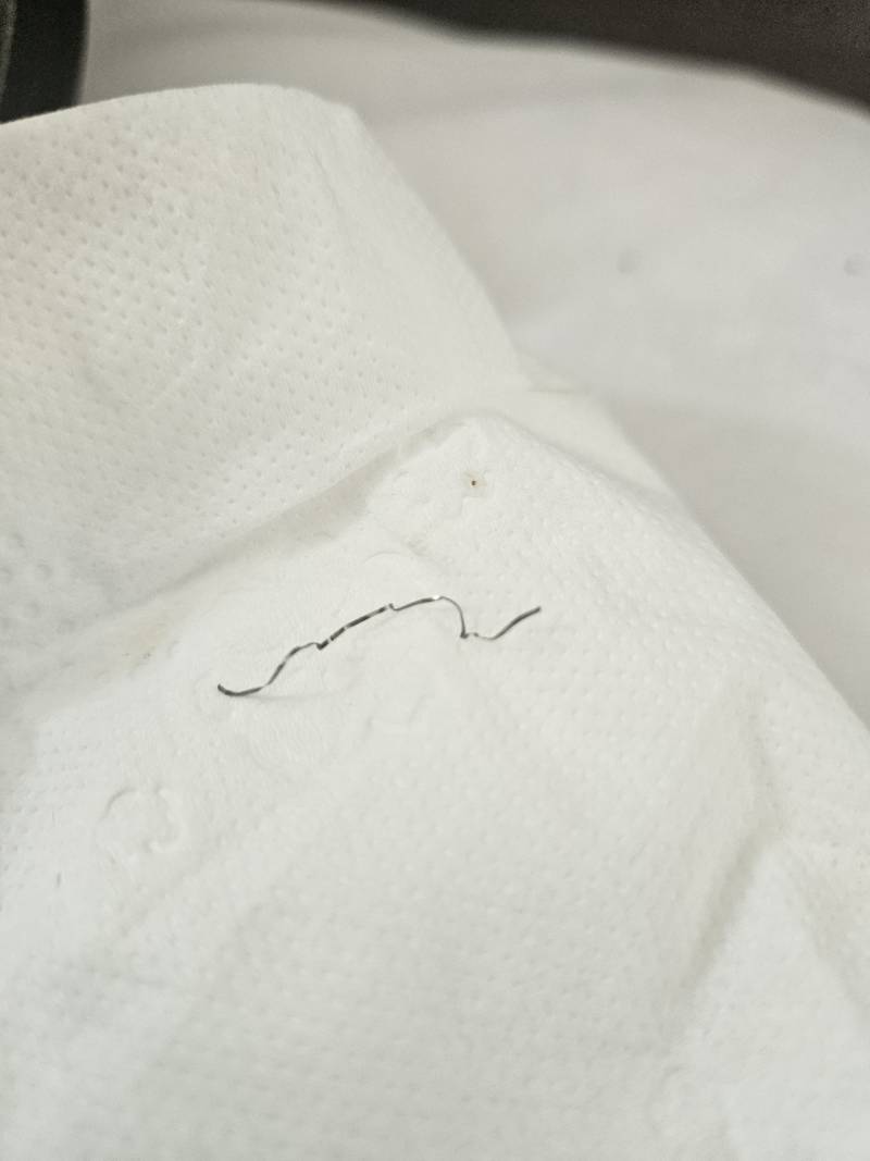 [잡담] 짜장면에서 철수세미 같은 게 나왔는데 전화걸어 말어...? | 인스티즈