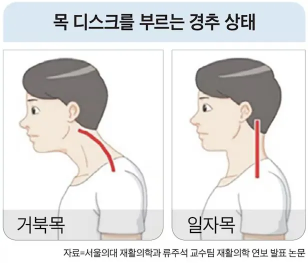 ⚠️현재 30만명 늘어서 국민병 수준이라는 질병..⚠️ | 인스티즈