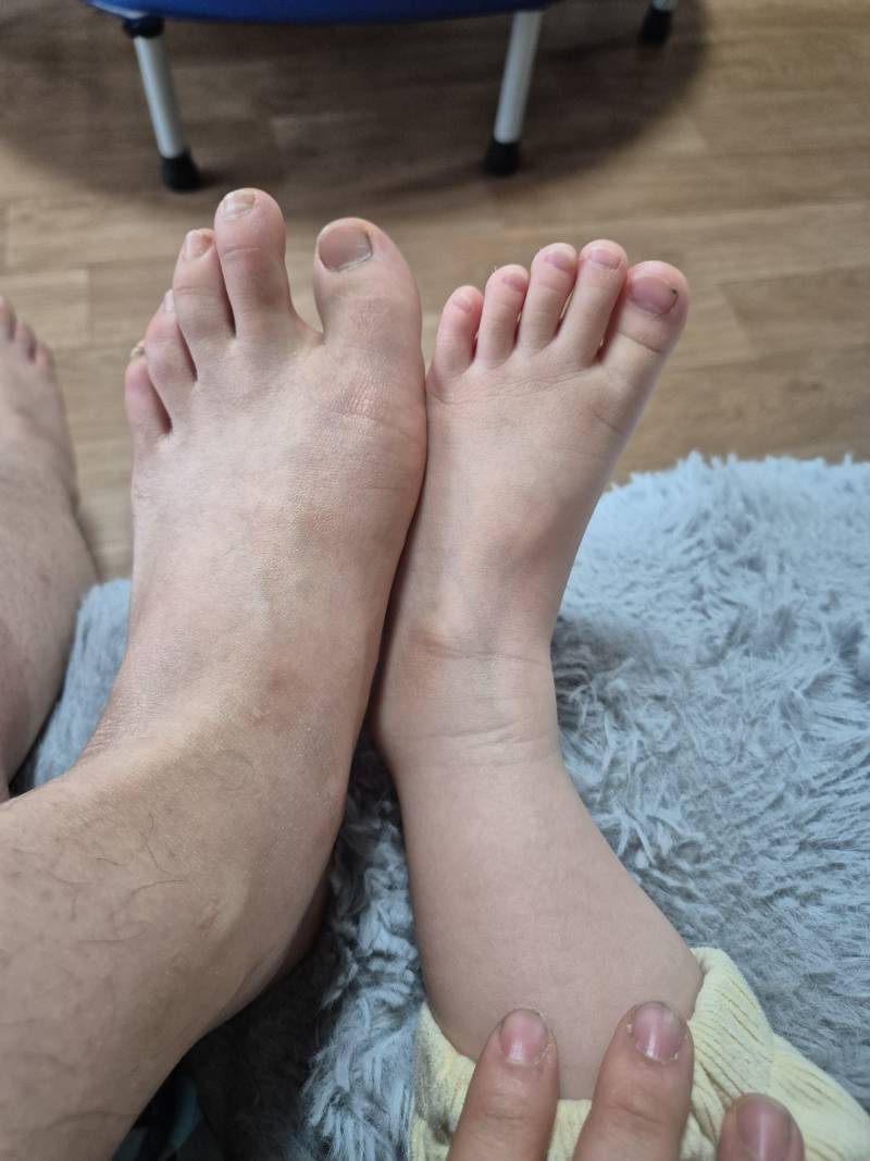 [잡담] 4살조카발가락길이 실화냐..... | 인스티즈