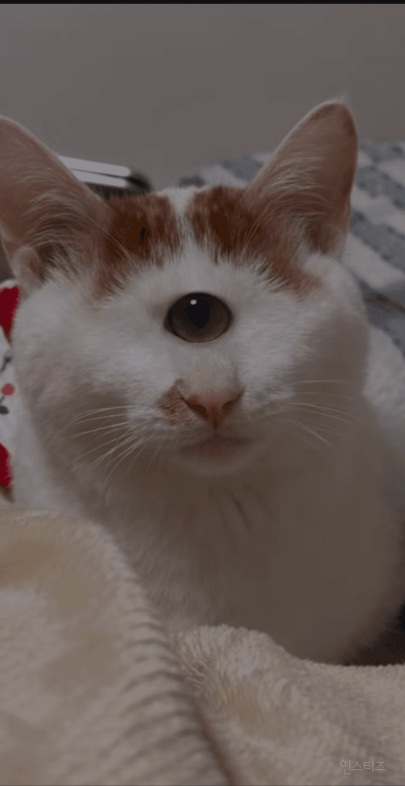 형아 ! 나 드디어 눈 기증받게 됐대 !!! | 인스티즈