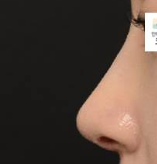 [잡담] 코성형 세미매부리로 할거야 | 인스티즈