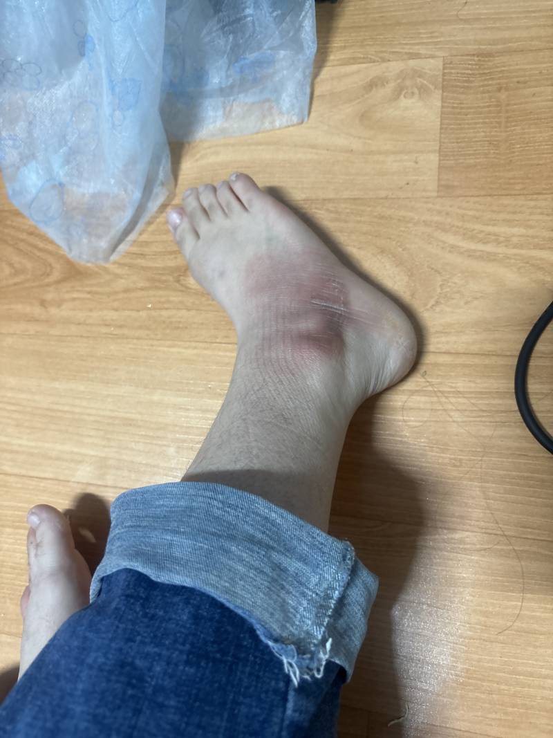 [잡담] 발관리꿀팁전수좀 | 인스티즈