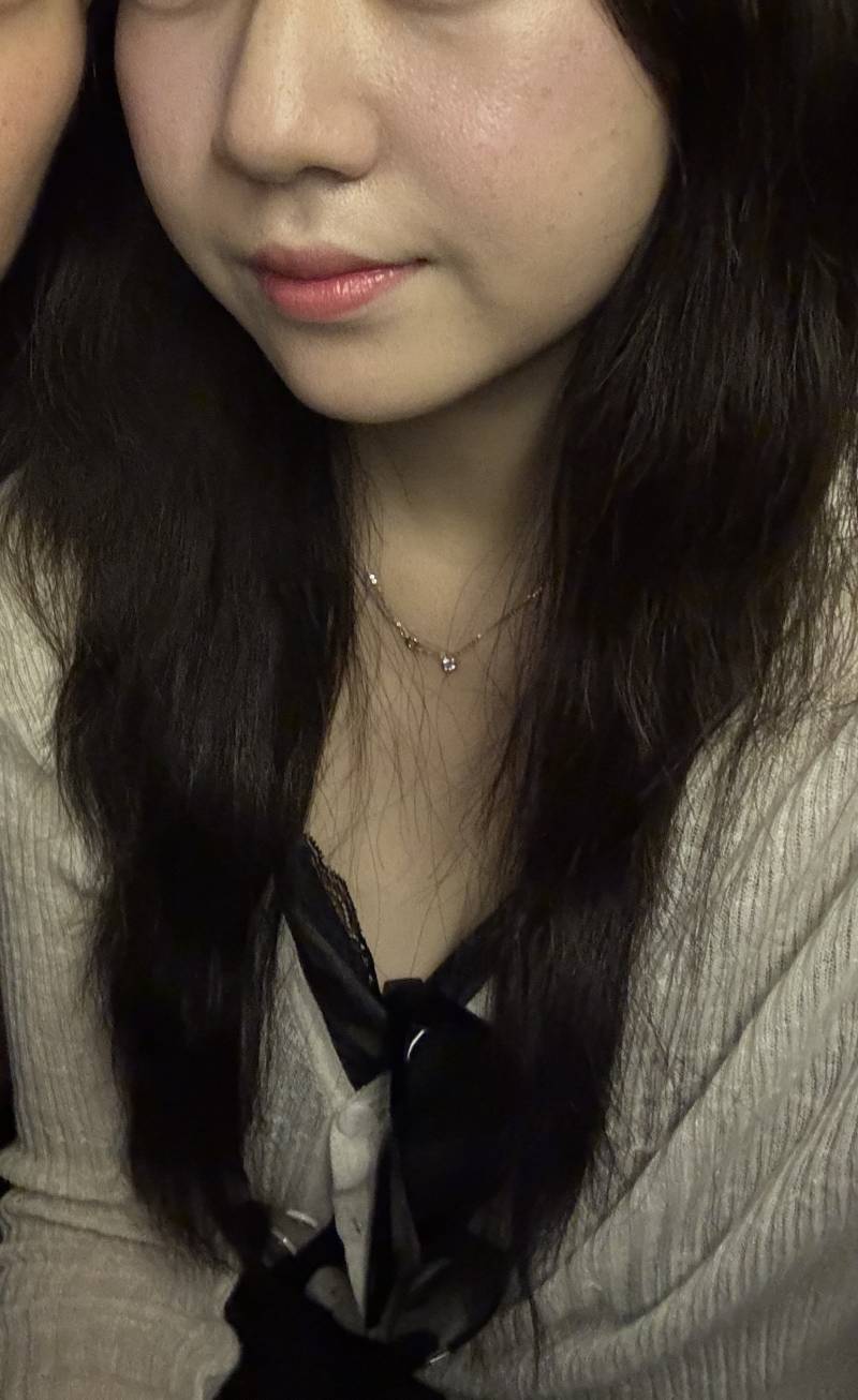 [잡담] 입술필러 받을까 말까 | 인스티즈