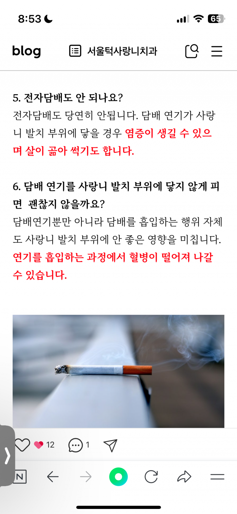 [잡담] 사랑니 발치 후 찾아보는데 개웃기다ㅠㅋㅋㅋㅋ | 인스티즈