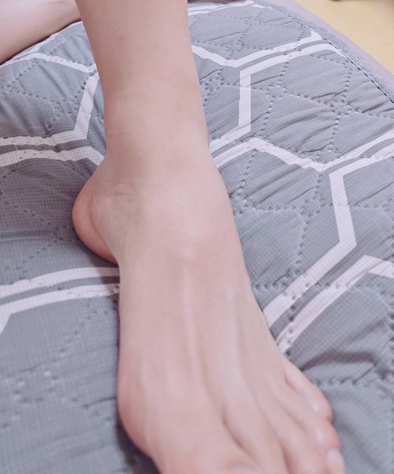 [잡담] 사진주의!!)레이저 제모 효과 개꿀이네 | 인스티즈