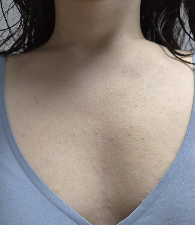 [잡담] 내 가슴팍은 대체 왜 이럴까..ㅠ하.. | 인스티즈